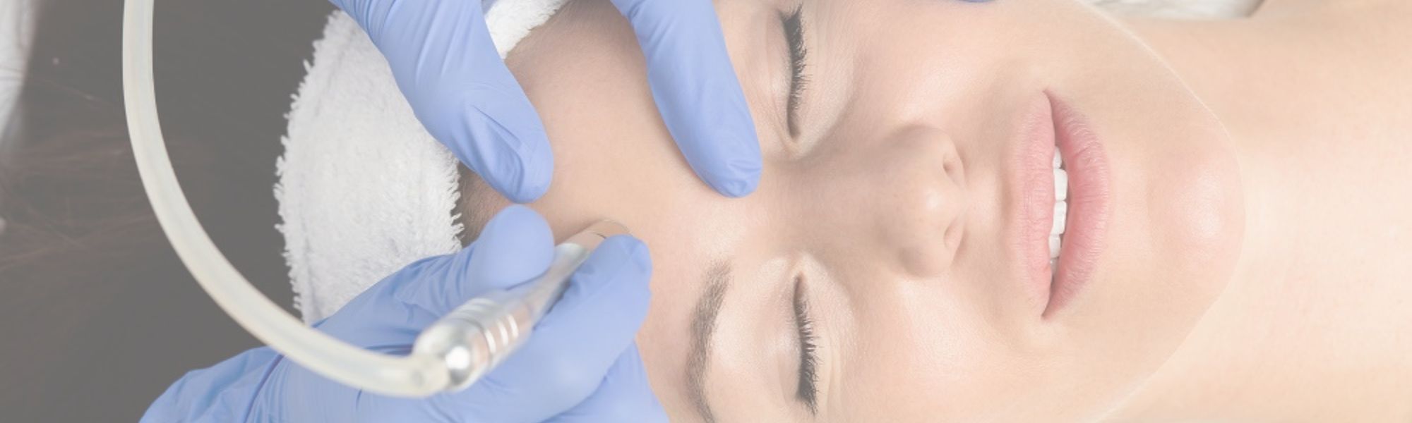 microneedling